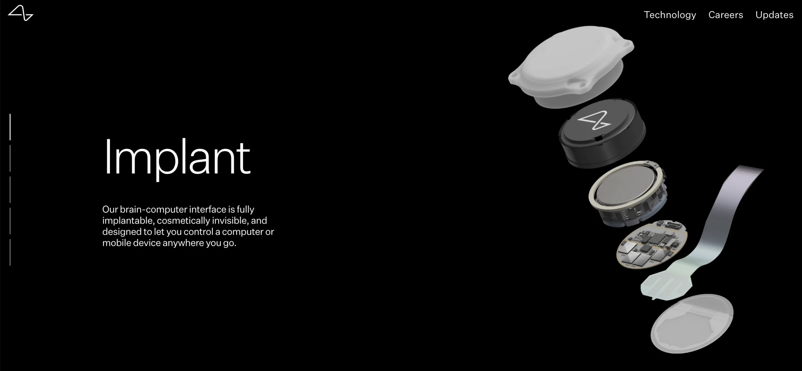 Η Neuralink μεταμορφώνει την καθημερινότητα: Χρήστης με εμφύτευμα ελέγχει webcam με τη σκέψη του 4 Η Neuralink μεταμορφώνει την καθημερινότητα: Χρήστης με εμφύτευμα ελέγχει webcam με τη σκέψη του