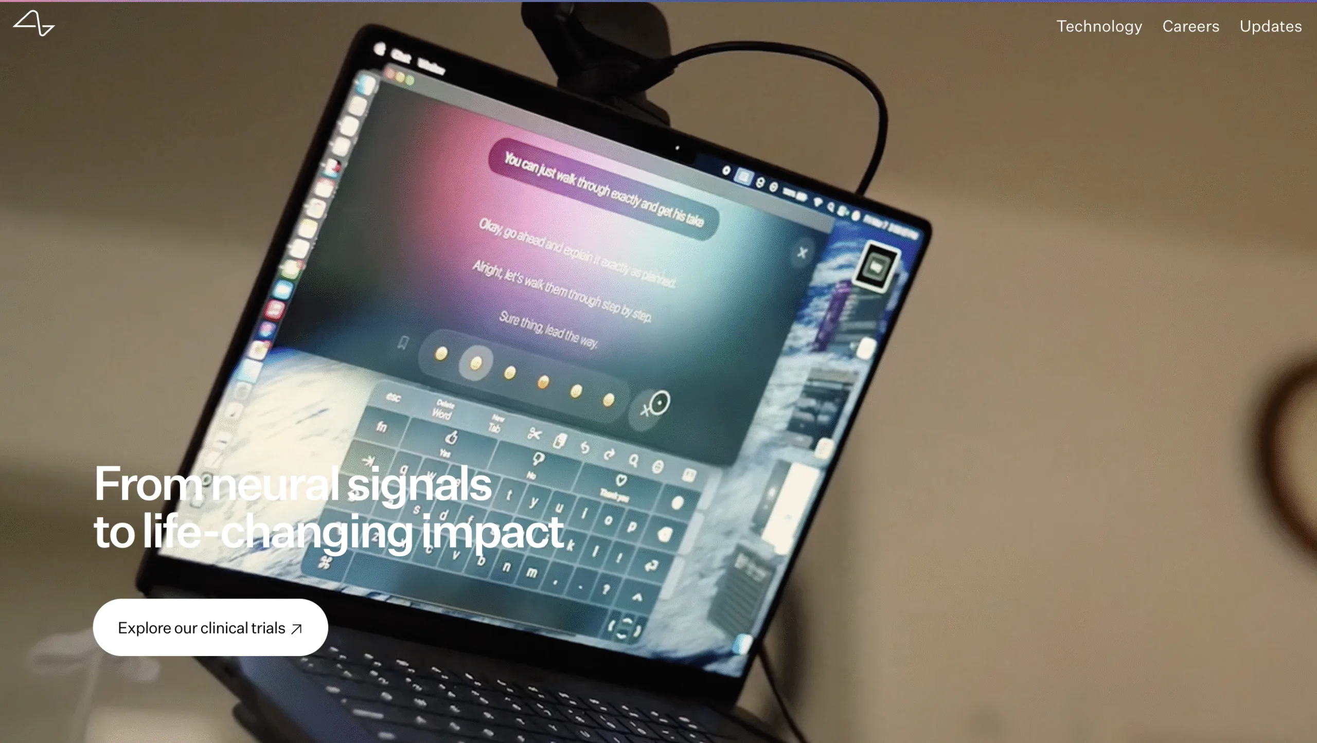 Η Neuralink μεταμορφώνει την καθημερινότητα: Χρήστης με εμφύτευμα ελέγχει webcam με τη σκέψη του 3 Η Neuralink μεταμορφώνει την καθημερινότητα: Χρήστης με εμφύτευμα ελέγχει webcam με τη σκέψη του