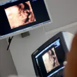 Η Google χρησιμοποιεί AI για να κάνει τους υπερήχους εγκυμοσύνης πιο προσβάσιμους