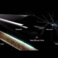 Η Neuralink του Elon Musk έχει έτοιμο το εμφύτευμα που φιλοδοξεί να δώσει όραση σε τυφλούς