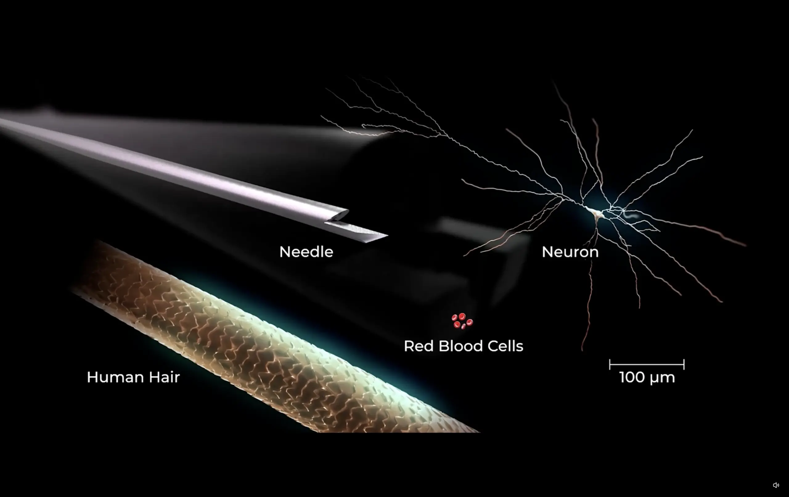 Neuralink Telepathy και Blindsight - Πώς λειτουργούν τα δύο εγκεφαλικά εμφυτεύματα του Elon Musk